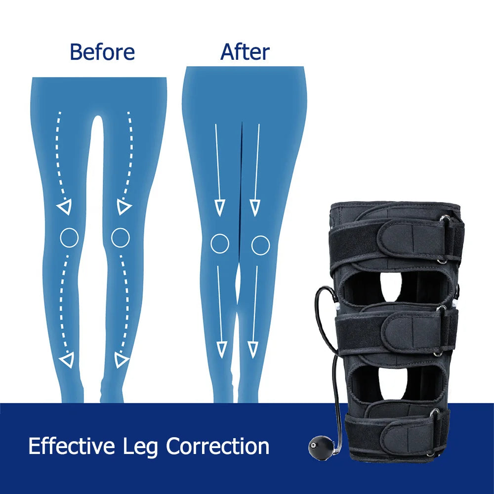Adjustable O/X Type Legs Correction